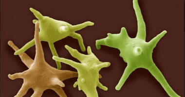 AMEBA(S) SPORTINGUISTA(S)